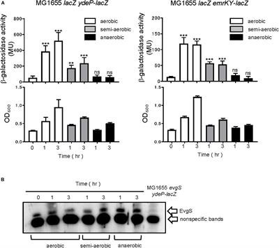 Acid-Sensing Histidine Kinase With a Redox Switch